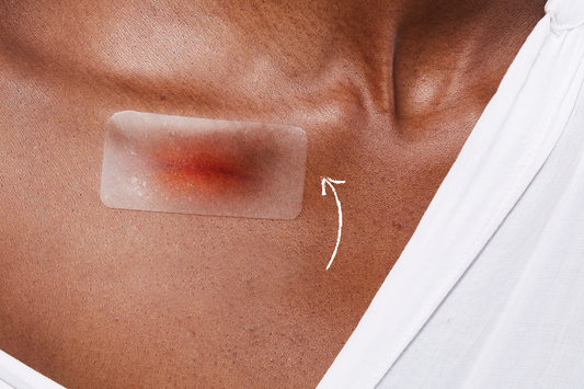 The Science Behind Moist Wound Healing: Why It's Better Than Dry Healing