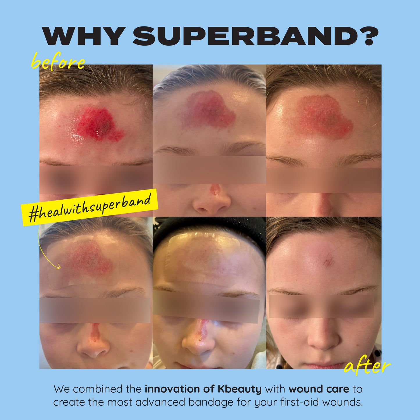 SUPERBAND