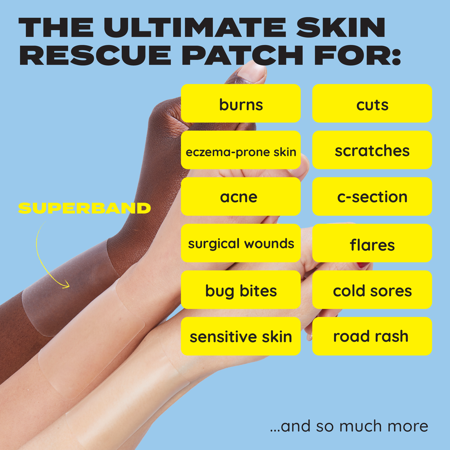 SUPERBAND Cut-To-Size