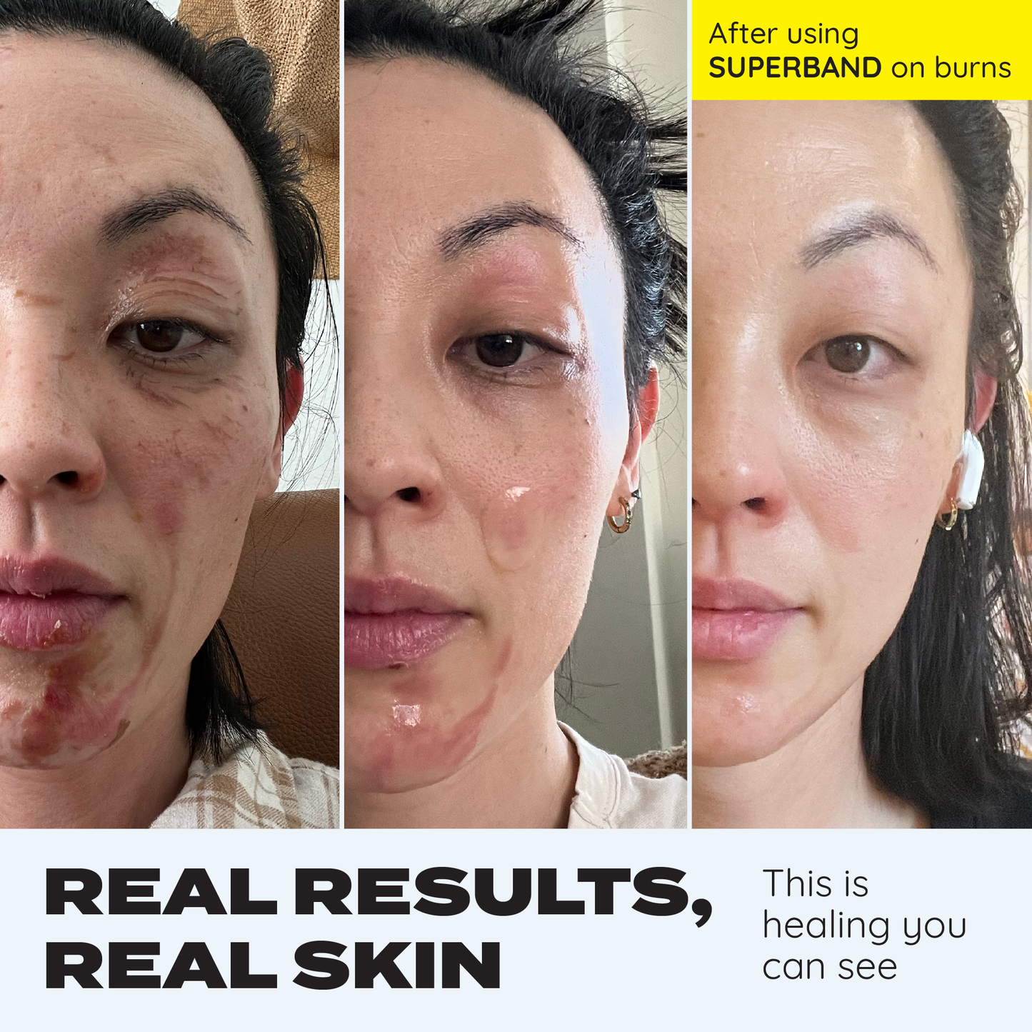 SUPERBAND Cut-To-Size